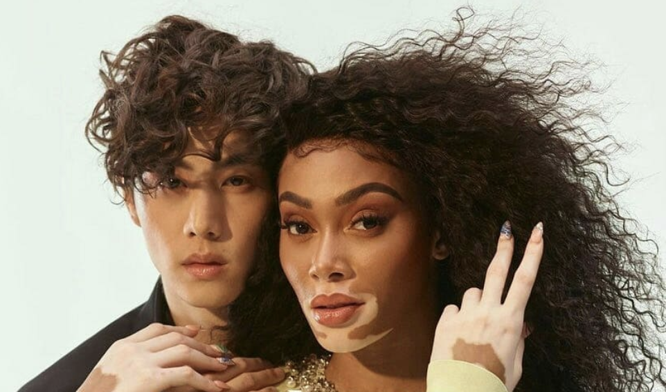 Mark Tuan Winnie Harlow